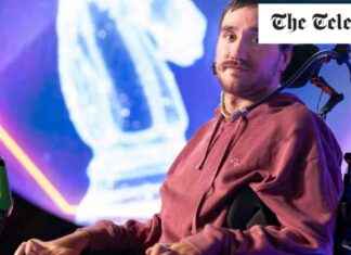 Elon Musk Brain Chip Implant: The Coolest Experience Ever news-14092024-065808