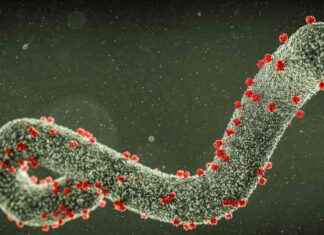 Marburg Virus: Symptoms, Vaccine, Outbreak, and Travel Bans – Everything You Need to Know news-07102024-065928