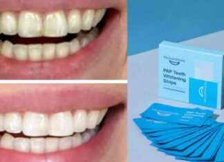 Impressive Teeth Whitener Deals Stack Up, Cheaper than Prime Day news-09102024-072505