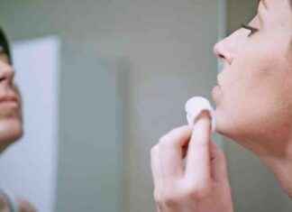 Maximizing Cold Sore Cream Application for Effective Results – London Business News news-16102024-213334