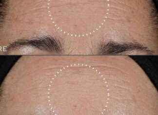 Save £35 on Medik8 Anti-Aging Regimen – Look 5 Years Younger! news-18102024-062238