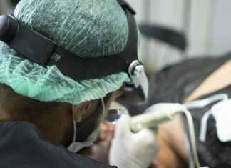 Your Guide to Hair Transplantation in Antalya: Achieve Natural Results with Ease