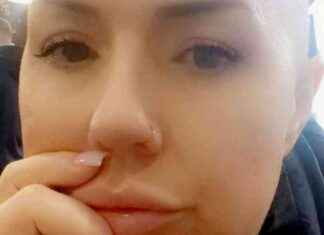 Scan Reveals Cancer Misdiagnosed as Cyst: A Survivor’s Story scan-reveals-cancer-misdiagnosed-as-cyst-a-survivors-story